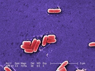 e coli on kin