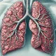 Pulmonary fibrosis