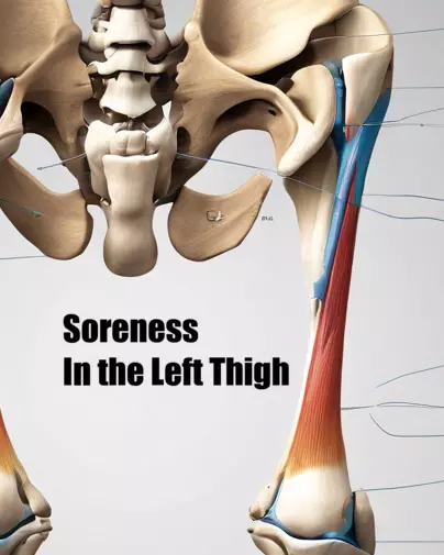 Soreness In the Left Thigh
