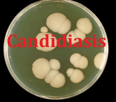 Yeast Infections (Candidiasis)