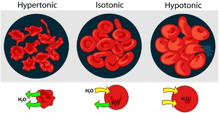 Normal and abnormal red blood cells