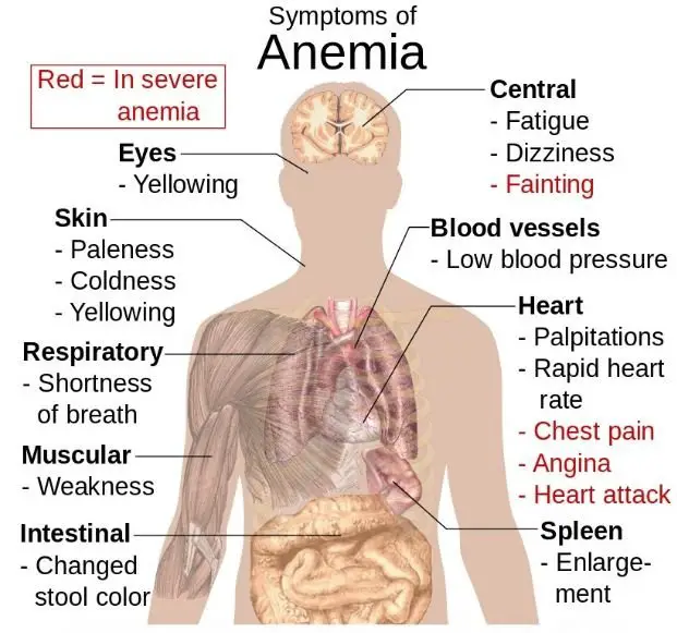Symptoms of anemia