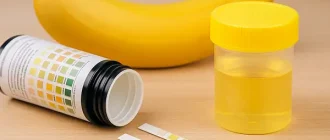 Home urine test strips with container and a banana on a wooden table, symbolizing diet effects and simple at-home diagnosis.