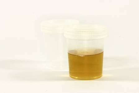 Urine for medical test
