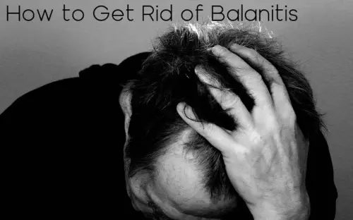 How to Get Rid of Balanitis