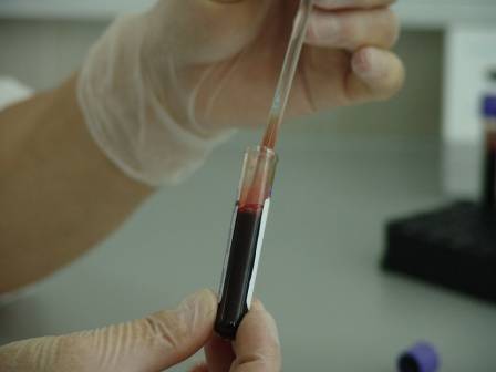 Blood test