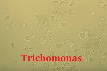 Trichomonas