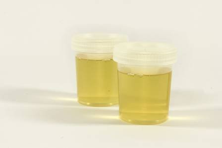 Two jars of urine
