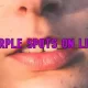 Purple Spots on Lips
