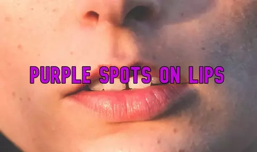 Purple Spots on Lips