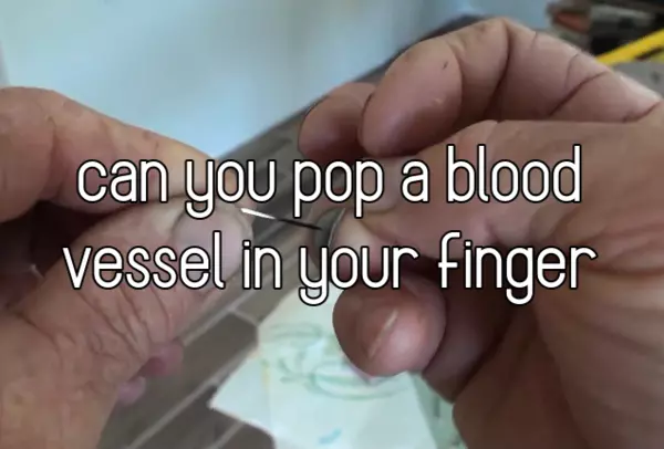 can you pop a blood vessel in your finger
