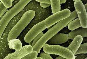 Orange-Brown Mucus in Stool: Causes and Treatment