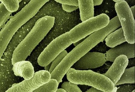 E. Coli infection