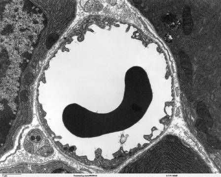 Photo of the capillary