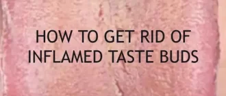 how to get rid of inflamed taste buds