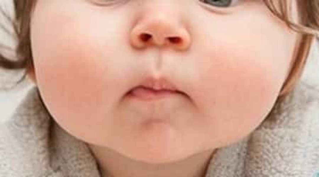 Big Fat Cheeks How to Remove Them Health Advisor