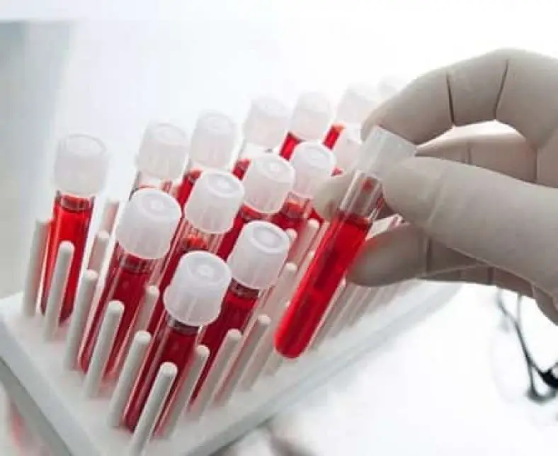 Meaning of High and Low ESR Count In Blood Test - Health Advisor