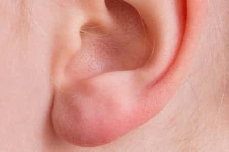 bumps inside ear