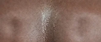 Cold sweat as a warning sign of underlying medical conditions in adult men