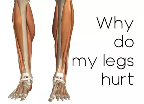 why do my legs hurt