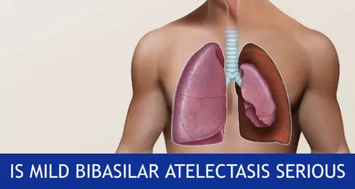 is mild bibasilar atelectasis serious