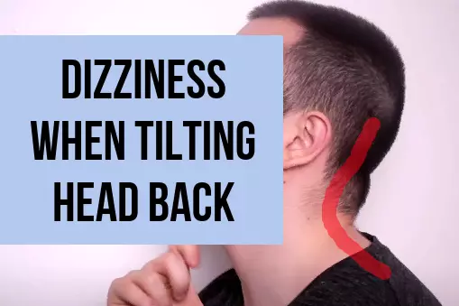 Dizziness When Tilting Head Back 