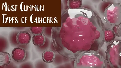 Most Common Types of Cancers