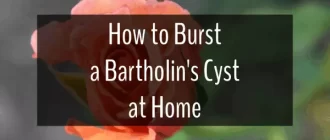 How to Burst a Bartholin's Cyst at Home