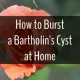 How to Burst a Bartholin's Cyst at Home