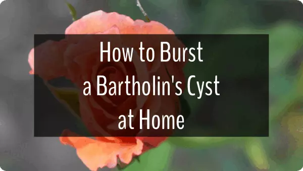 How to Burst a Bartholin's Cyst at Home