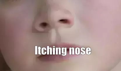 Itching nose