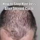 How to Stop Hair Loss After Steroid Cycle