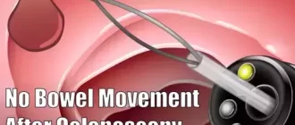 No Bowel Movement After Colonoscopy