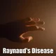 Raynaud's Disease