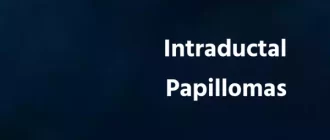 Intraductal Papillomas