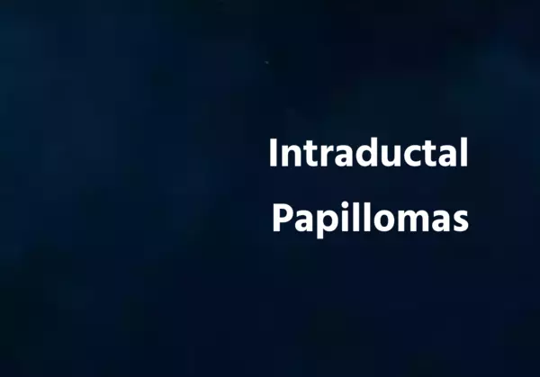 Intraductal Papillomas
