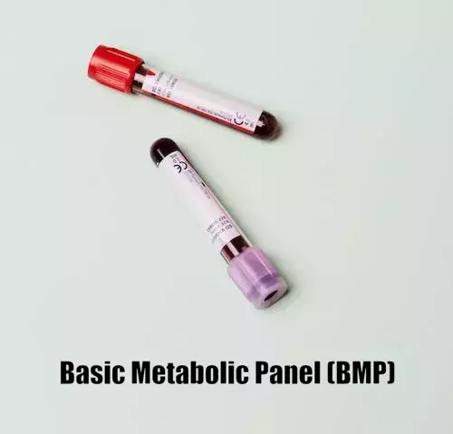 Basic Metabolic Panel (BMP)