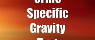 Urine Specific Gravity Test