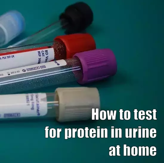 How to test for protein in urine at home