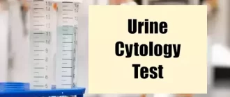 Urine Cytology