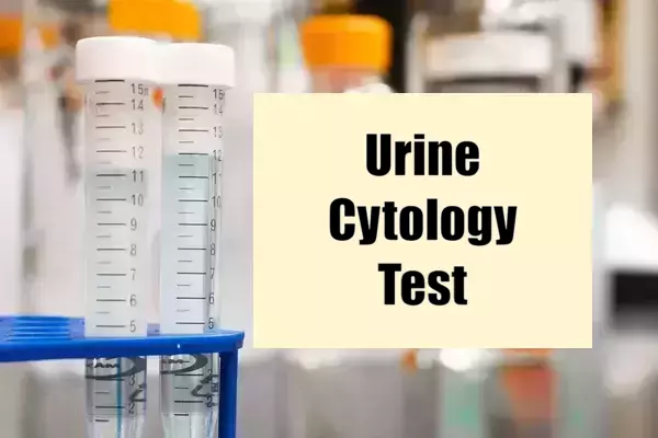 Urine Cytology