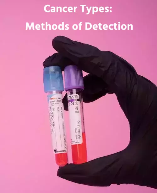 Cancer Types: Methods of Detection