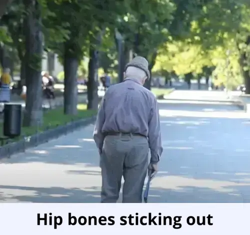 Hip bones sticking out