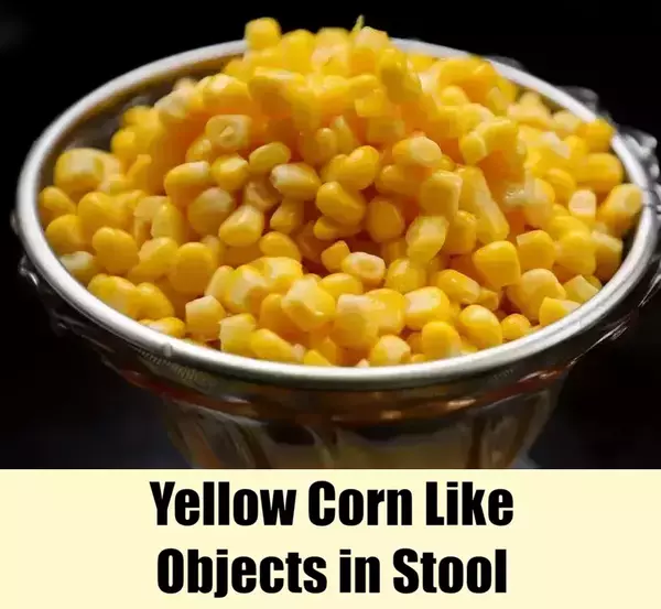 Yellow Corn Like Objects in Stool