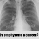 Is emphysema a cancer?