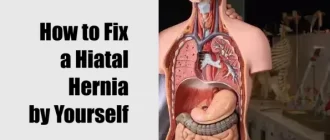 How to Fix a Hiatal Hernia by Yourself