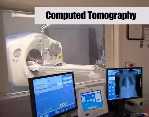 Computed Tomography