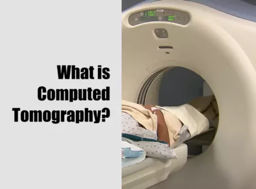 What is Computed Tomography?
