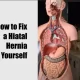 How to Fix a Hiatal Hernia by Yourself