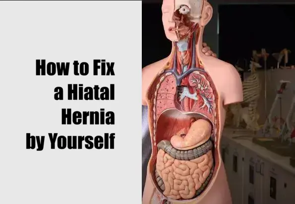 How to Fix a Hiatal Hernia by Yourself